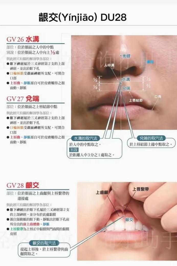 原图 101